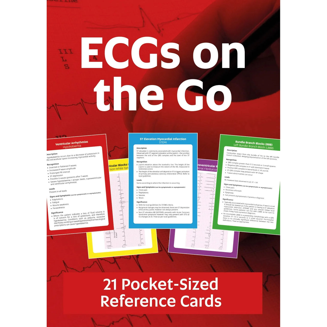 ECGs On The Go - 21 Pocket-Sized Reference Cards